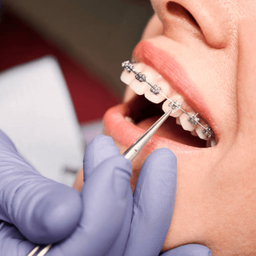 Orthodontist braces check-up at Heaton Mersey Orthodontic Centre in Manchester