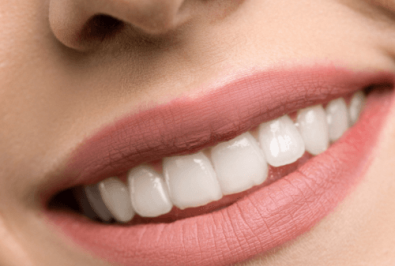 Can You Eat With Clear Braces?